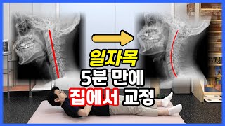 현대인의 고질병 일자목, 간단 자가진단 \u0026 교정운동