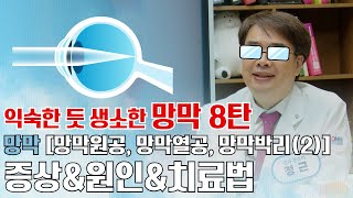 E59_망막[망막원공, 망막열공, 망막박리(2)]