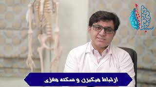 ارتباط میگرن با سکته مغزی