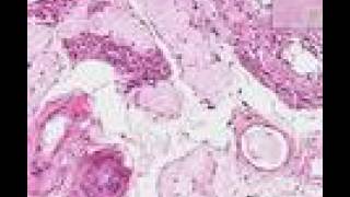 Histopathology Testis --Atrophy