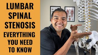 Lumbar Spinal Stenosis - Everything You Absolutely Need To Know