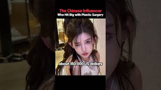 Plastic Surgery Made Her A Star China S Viral Influencer Plastic Info K
