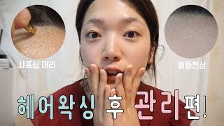 [요청]샤프심처럼 되나요?유지기간은? ✔️헤어라인 왁싱 후 관리법!!✔️