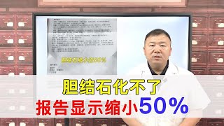 胆结石化不小？复诊前后彩超报告，证明胆结石缩小了近50%