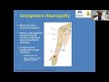 entrapment neuropathy overview