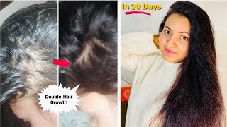 CASTOR HAIR GROWTH CHALLENGE : Use Castor Oil like this for 30 Days | Double Hair Growth & Density