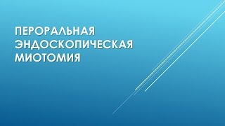 Пероральная эндоскопическая миотомия