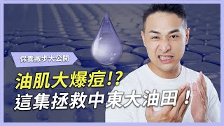 油肌大爆痘！？這集拯救中東大油田！｜Rachel Wine 瑞秋懷恩