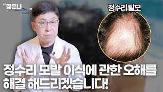 정수리 모발 이식이 어려운 이유.. 이 영상 보시고 고민 해결하세요!!