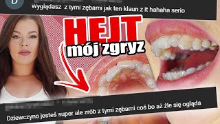 DENTYŚCI NIE CHCIELI SIĘ PODJĄĆ LECZENIA!  Założyłam aparat za 15.000 DLACZEGO? Royal Dental