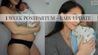 1 WEEK POSTPARTUM | 1 WEEK BABY UPDATE | MEET MY BABY