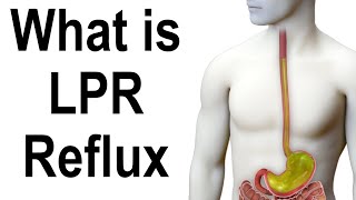 What is LPR (Laryngopharyngeal Reflux)? Acidic & Non-Acidic Throat Reflux