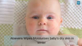 Mee Mee Wet Wipes | Winter Skin Care for Babies