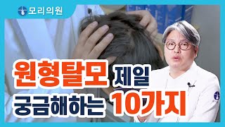 원형탈모 관련 질문 중 가장 많은 10가지!!