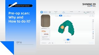 Intraoral Scan Course EP16｜Pre-op scan: Why and How to do it｜Scan Process