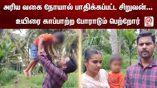 அரிய வகை நோயால் பாதிக்கப்பட்ட சிறுவன்... உயிரை காப்பாற்ற போராடும் பெற்றோர் | Muscle Tear Disease