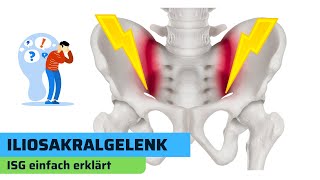 Iliosakralgelenk (ISG): Grundlagen bei Rückenschmerzen