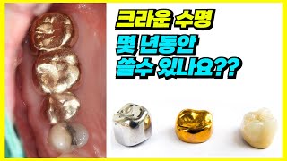 크라운 몇년동안 쓸 수 있나요?ㅣ크라운 수명