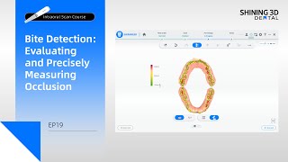 Intraoral Scan Course EP19｜Bite Detection: Evaluating and Precisely Measuring Occlusion｜Pre-Design