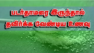 படர் தாமரை இருந்தால் தவிர்க்க வேண்டிய உணவு பொருட்கள் | Ringworm Food Control | In the search