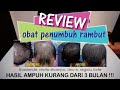 Review Obat Anti Botak (Finasteride, Revita Shampoo, DNC-N, Minoxidil 5% - Lebat Kurang Dari 3 Bln)