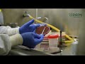 processing of respiratory tract specimens