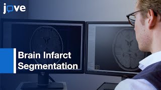 Brain Infarct Segmentation and MRI Registration for Lesion-Symptom Mapping