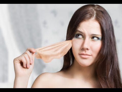 How to Treat Pimples Under the Skin - Cystic Acne Treament How to Treat Pimples Under the Skin - Cystic Acne Treament