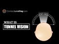 What's Tunnel Vision Symptoms and Loss of Peripheral Vision