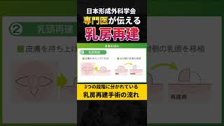 乳房再建手術の流れ - 形成外科学会専門医が解説