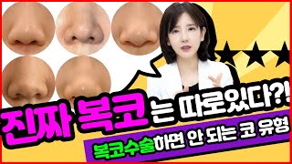 복코처럼 보이는 가짜 복코를 아시나요? 성형외과전문의의 가짜 복코vs진짜 복코 분석!