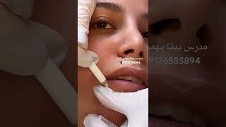 آموزش تزریق فیلر لب #آموزش #اموزش #آموزش_مجازی #فیلر #ژل_لب #lip#injectionlip#filler