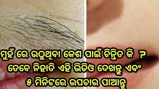 ଝିଅମାନେ ମୁହଁରେ ଉଠୁଥିବା ଚୁଟି ପାଇଁ ଚିନ୍ତିତ ଅଛନ୍ତି କି, ତେବେ ଏ ଗୋଟିଏ ଉପାୟରେ ଦୂର ହୋଇଯିବ ଆପଣଙ୍କ ଟେନ୍ସନ୍