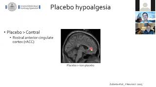 Neuronal mechanisms of placebo and nocebo effects