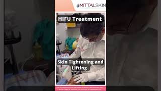 HIFU MACHINE an Advanced Painless, Non-Injectable \u0026 Non Surgical, High-tech Machine