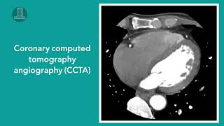 پشکنینی خوێنبەرەکانی دڵ بە بەکارهێنانی ئامێری تیشکی سی تی CT scan