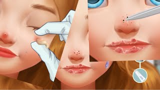 ASMR Remove unmanaged piercing 2d animation | Squeeze nose acne