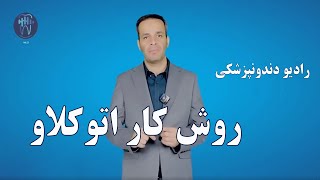 روش کار اتوکلاو