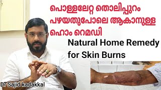 Natural Home Remedy for Burend Skin,തൊലിപ്പുറത്തെ പൊള്ളൽ മാറി പഴയ അവസ്ഥയിലേക്ക് എത്താൻ ഉള്ള ഹോംറെമഡി