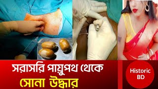 সরাসরি মলদ্বার থেকে সোনা উদ্ধার | Gold recovered from the anus | Gold Smuggling | Historic BD