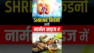 SHRINK किडनी आयी नार्मल साइज में | Karma Ayurveda Reviews | #shorts #kidney #patienttestimonial