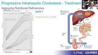 Medical Treatment Options of PFIC