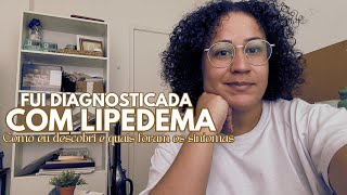 FUI DIAGNOSTICADA COM LIPEDEMA | Como foi que descobri e quais foram os sintomas.