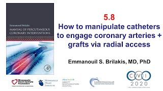 5.8 Manual of PCI - How to manipulate catheters to engage via radial access