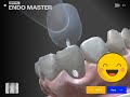 Oops! Penetration Cut Failed-Dental EndoMaster