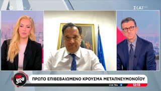 Ο Άδωνις Γεωργιάδης με τους Άρη Πορτοσάλτε και Μαρία Αναστασοπούλου στον ΣΚΑΪ 08.01.2025