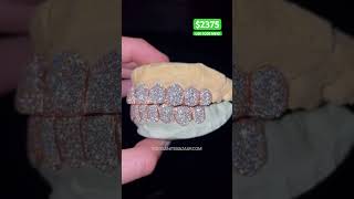 10 on 10 VVS Moissanite Grillz on 925 Silver With Rose Gold Plating