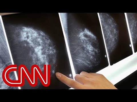 Groundbreaking study says some breast cancer patients may not need chemo Groundbreaking study says some breast cancer patients may not need chemo