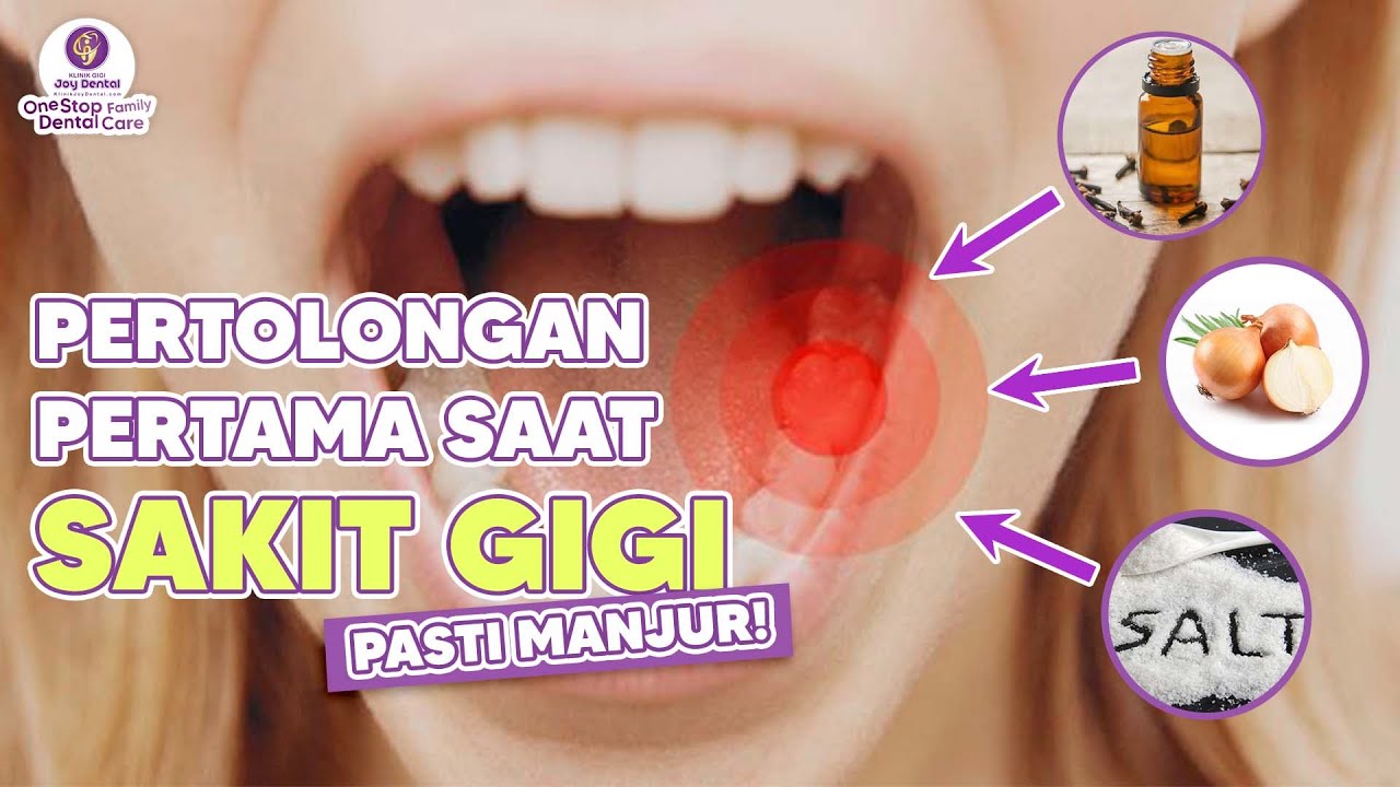 4 CARA MENYEMBUHKAN SAKIT GIGI - YouTube