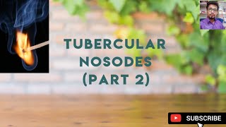 Aviare, Phosphorus and Other Remedies |Tubercular Nosodes Discussion (Part 2)